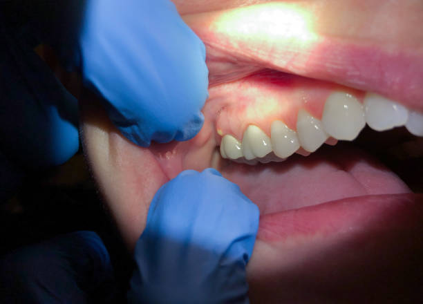 Best Cracked Tooth Emergency Dentist  in Victoria, MS